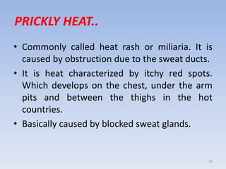 PRICKLY HEAT..
• Commonly called heat rash or miliaria. It is
caused by obstruction due to the sweat ducts.
• It is heat characterized by itchy red spots.
Which develops on the chest, under the arm
pits and between the thighs in the hot
countries.
• Basically caused by blocked sweat glands.
10
 
