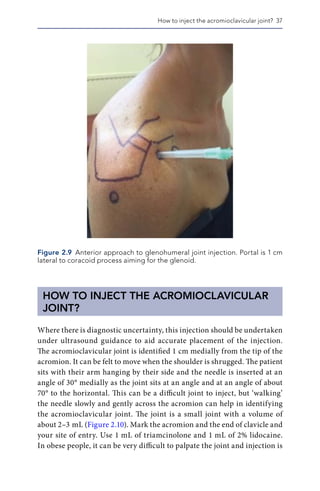 Maneesh Bhatia (Editor) - Musculoskeletal Injections and Alternative ...