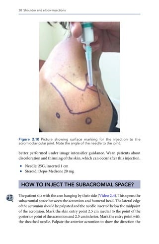 Maneesh Bhatia (Editor) - Musculoskeletal Injections and Alternative ...