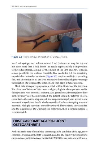 Intersection Injection Maneesh Bhatia (Editor) - Musculoskeletal Injections and Alternative ...