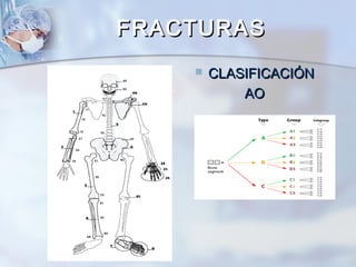 FRACTURASFRACTURAS
 CLASIFICACIÓNCLASIFICACIÓN
AOAO
 