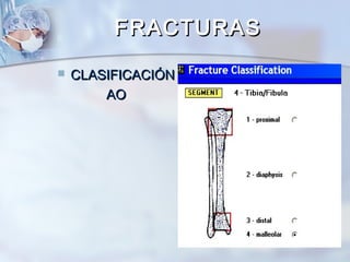  CLASIFICACIÓNCLASIFICACIÓN
AOAO
FRACTURASFRACTURAS
 