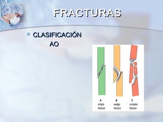  CLASIFICACIÓNCLASIFICACIÓN
AOAO
FRACTURASFRACTURAS
 