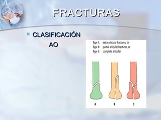  CLASIFICACIÓNCLASIFICACIÓN
AOAO
FRACTURASFRACTURAS
 