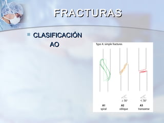  CLASIFICACIÓNCLASIFICACIÓN
AOAO
FRACTURASFRACTURAS
 