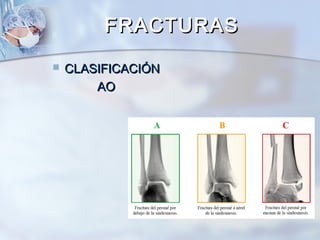 FRACTURASFRACTURAS
 CLASIFICACIÓNCLASIFICACIÓN
AOAO
 