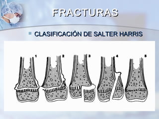  CLASIFICACIÓN DE SALTER HARRISCLASIFICACIÓN DE SALTER HARRIS
FRACTURASFRACTURAS
 
