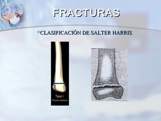 CLASIFICACIÓN DE SALTER HARRISCLASIFICACIÓN DE SALTER HARRIS
FRACTURASFRACTURAS
 