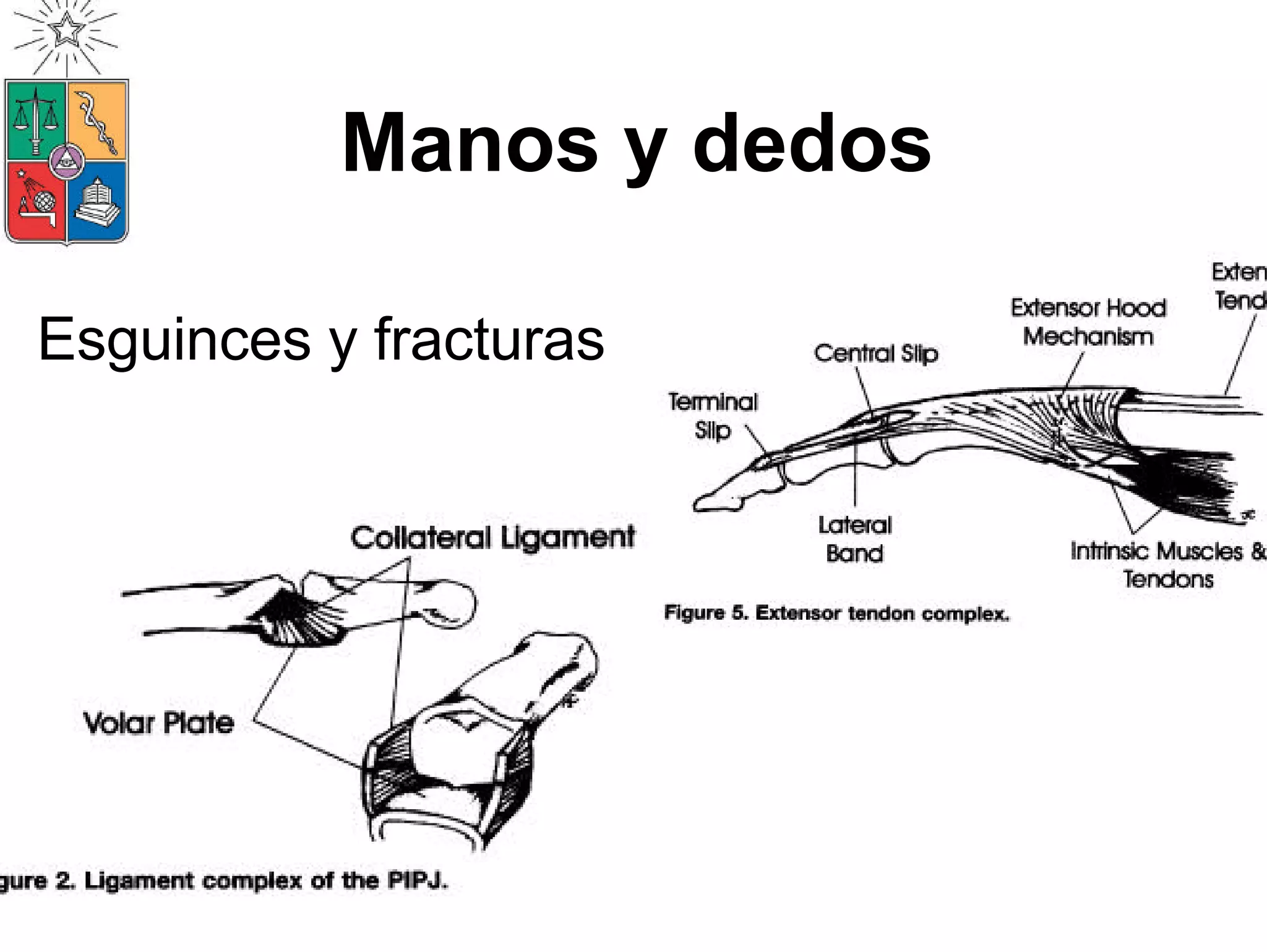 Manejo De Lesiones de EESS 2