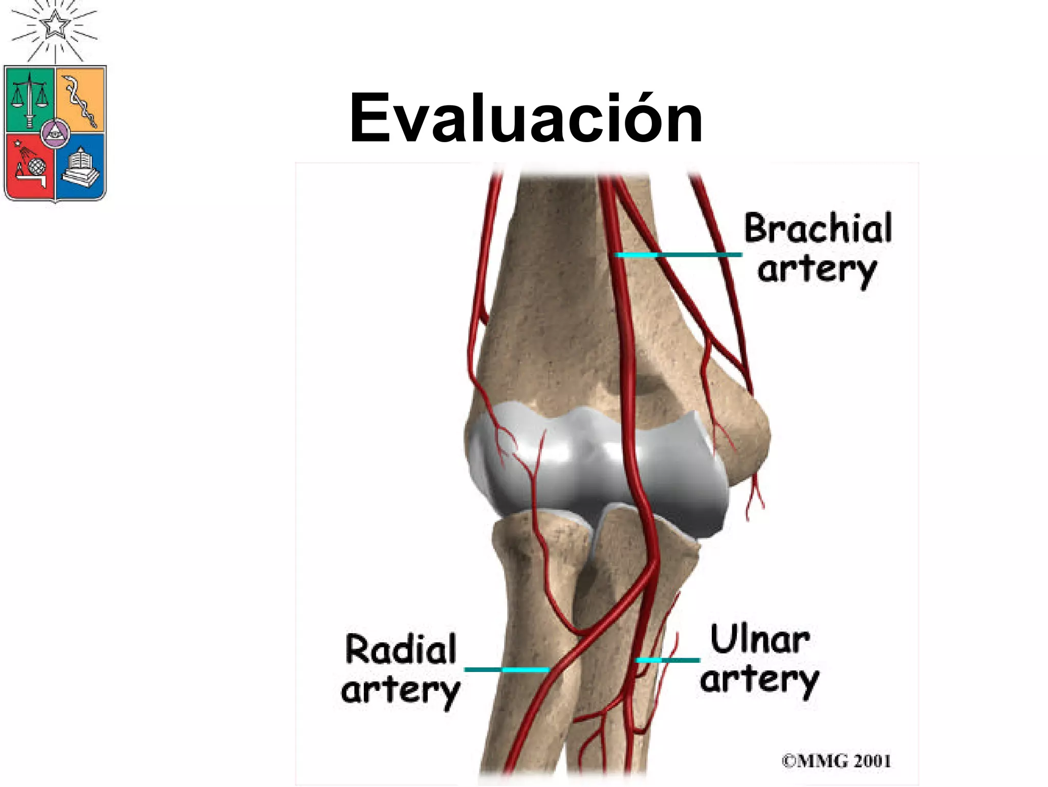 Manejo De Lesiones de EESS 2