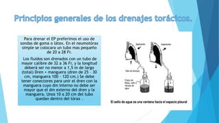 Para drenar el EP preferimos el uso de
sondas de goma o látex. En el neumotórax
simple se colocara un tubo mas pequeño
de 20 a 28 Fr.
Los fluidos son drenados con un tubo de
mayor calibre de 32 a 36 Fr, y la longitud
deberá ser no menor a 1,5 m de largo
(total) Dren + manguera (dren de 25 – 30
cm, manguera 100 – 120 cm.) Se debe
tener conectores para unir el dren con la
manguera cuyo dm interno no debe ser
mayor que el dm externo del dren y la
manguera. Unos 10 a 20 cm del tubo
quedan dentro del tórax .
 