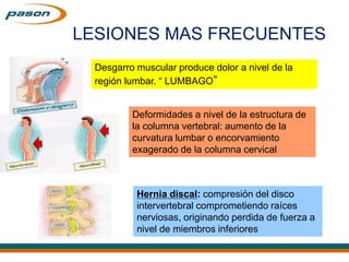 LESIONES MAS FRECUENTES
Desgarro muscular produce dolor a nivel de la
región lumbar. “ LUMBAGO”
Deformidades a nivel de la estructura de
la columna vertebral: aumento de la
curvatura lumbar o encorvamiento
exagerado de la columna cervical
Hernia discal: compresión del disco
intervertebral comprometiendo raíces
nerviosas, originando perdida de fuerza a
nivel de miembros inferiores
 