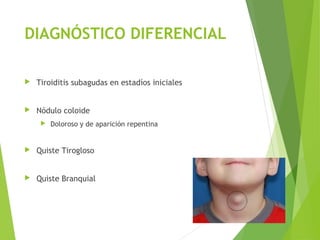 DIAGNÓSTICO DIFERENCIAL
 Tiroiditis subagudas en estadíos iniciales
 Nódulo coloide
 Doloroso y de aparición repentina
 Quiste Tirogloso
 Quiste Branquial
 