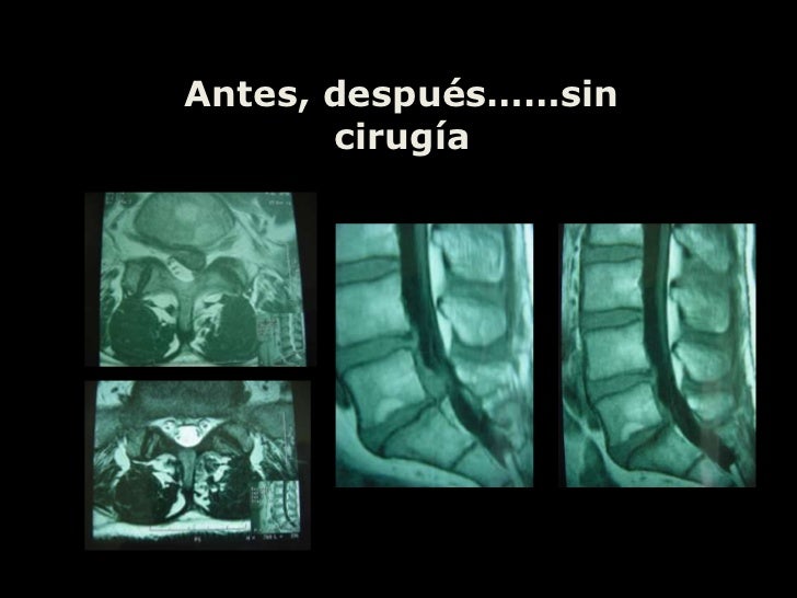 El sitio la clínica de los tratamientos de la columna vertebral