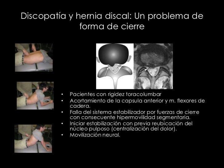 El dolor agudo en la parte izquierda de los riñones