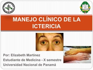Por: Elizabeth Martínez
Estudiante de Medicina - X semestre
Universidad Nacional de Panamá
MANEJO CLÍNICO DE LA
ICTERICIA
 