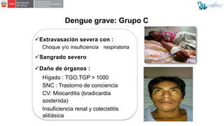 Dengue grave: Grupo C
 Dengue grave en UCI.
 Iniciar tratamiento con CRISTALOIDES
a 20 ml/kg en bolo (en 15 minutos)
par...