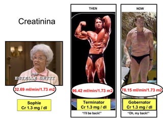Creatinina




32.69 ml/min/1.73 m2   96.42 ml/min/1.73 m2   78.15 ml/min/1.73 m2


      Sophie                Terminator           Gobernator
   Cr 1.3 mg / dl          Cr 1.3 mg / dl       Cr 1.3 mg / dl
 