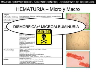 MANEJO COMPARTIDO DEL PACIENTE CON ERC -DOCUMENTO DE CONSENSO-


                     HEMATURIA – Micro y Macro
  Origen
 Enfermedad Sistémica

 Enfermedad Infecciosa
 Glomerular


                 DISMÓRFICA+/-MICROALBUMINURIA
  Renal




 Vía urinaria baja




 Incierto
 