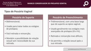 MANEJO CONSERVADOR DO PROLAPSO GENITAL
portaldeboaspraticas.iff.fiocruz.br
Tipos de Pessário Vaginal
Pessário de Suporte
• Bidimensional;
• Usado para tratar todos os estágios
de prolapso;
• Fácil retirada e reinserção;
• Mantém a possibilidade de relação
sexual sem necessidade da sua
retirada.
Pessário de Preenchimento
• Tridimensional, com uma base larga
que dá suporte ao ápice vaginal;
• Usado geralmente nos estágios mais
avançados de prolapso (III e IV);
• Retirada e reinserção mais difíceis;
• Só permite a relação sexual após a
sua retirada.
 