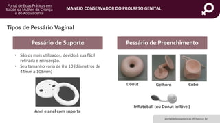 MANEJO CONSERVADOR DO PROLAPSO GENITAL
portaldeboaspraticas.iff.fiocruz.br
Anel e anel com suporte
Tipos de Pessário Vaginal
Pessário de Suporte Pessário de Preenchimento
• São os mais utilizados, devido à sua fácil
retirada e reinserção.
• Seu tamanho varia de 0 a 10 (diâmetros de
44mm a 108mm)
Donut Gelhorn Cubo
Inflatoball (ou Donut inflável)
 