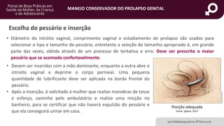 MANEJO CONSERVADOR DO PROLAPSO GENITAL
portaldeboaspraticas.iff.fiocruz.br
• Diâmetro do intróito vaginal, comprimento vaginal e estadiamento do prolapso são usados para
selecionar o tipo e tamanho do pessário, entretanto a seleção do tamanho apropriado é, em grande
parte das vezes, obtida através de um processo de tentativa e erro. Deve ser prescrito o maior
pessário que se acomoda confortavelmente.
• Devem ser inseridos com a mão dominante, enquanto a outra abre o
introito vaginal e deprime o corpo perineal. Uma pequena
quantidade de lubrificante deve ser aplicada na borda frontal do
pessário.
• Após a inserção, é solicitado à mulher que realize manobras de tosse
e esforço, caminhe pelo ambulatório e realize uma micção no
banheiro, para se certificar que não haverá expulsão do pessário e
que ela conseguirá urinar em casa.
Posição adequada
Fonte: Iglesia, 2017
Escolha do pessário e inserção
 