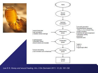 Lee D S. Honey and wound healing. Am J Clin Dermatol 2011; 12 (3): 181-190
 