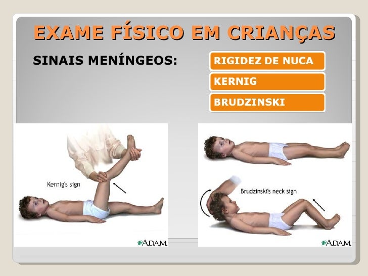 Exame meningite