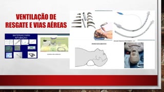 VENTILAÇÃO DE
RESGATE E VIAS AÉREAS
 