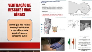 VENTILAÇÃO DE
RESGATE E VIAS
AÉREAS
Vítima que não respira
ou respira de forma
anormal (somente
gasping), porém
apresenta pulso.
 