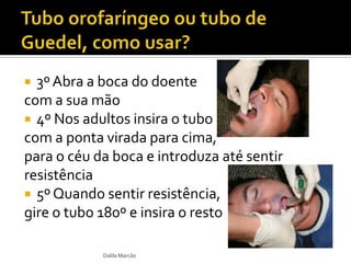  3º Abra a boca do doente
com a sua mão
 4º Nos adultos insira o tubo
com a ponta virada para cima,
para o céu da boca e introduza até sentir
resistência
 5º Quando sentir resistência,
gire o tubo 180º e insira o resto
Dalila Marcão
 