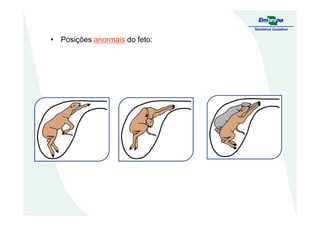 • Posições anormais do feto:
 