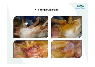 • Cirurgia Cesariana
 