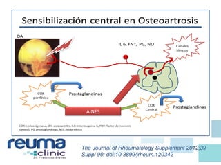 AINES
The Journal of Rheumatology Supplement 2012;39
Suppl 90; doi:10.3899/jrheum.120342
 