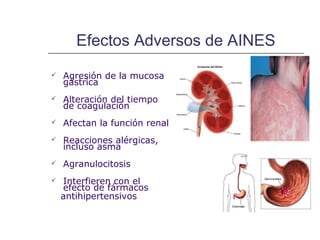 Efectos Adversos de AINES
   Agresión de la mucosa
    gástrica
   Alteración del tiempo
    de coagulación
   Afectan la función renal
   Reacciones alérgicas,
    incluso asma
   Agranulocitosis
   Interfieren con el
    efecto de fármacos
    antihipertensivos
 