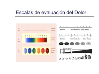 Escalas de evaluación del Dolor
 