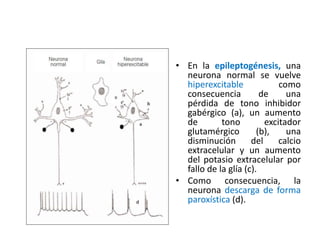 • En la epileptogénesis, una
neurona normal se vuelve
hiperexcitable como
consecuencia de una
pérdida de tono inhibidor
gabérgico (a), un aumento
de tono excitador
glutamérgico (b), una
disminución del calcio
extracelular y un aumento
del potasio extracelular por
fallo de la glía (c).
• Como consecuencia, la
neurona descarga de forma
paroxística (d).
 