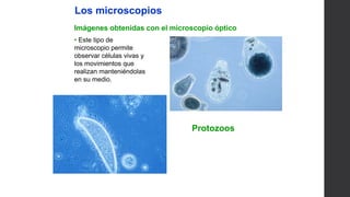 UNIDAD
1
Los microscopios
Imágenes obtenidas con el microscopio óptico
• Este tipo de
microscopio permite
observar células vivas y
los movimientos que
realizan manteniéndolas
en su medio.
Protozoos
 