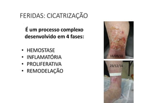 É um processo complexo
desenvolvido em 4 fases:
• HEMOSTASE
• INFLAMATÓRIA
• PROLIFERATIVA
• REMODELAÇÃO
FERIDAS: CICATRIZAÇÃO
16/09/16
23/12/16
 