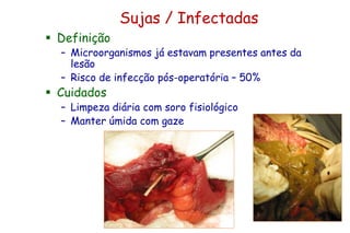 Sujas / Infectadas
 Definição
– Microorganismos já estavam presentes antes da
lesão
– Risco de infecção pós-operatória – 50%
 Cuidados
– Limpeza diária com soro fisiológico
– Manter úmida com gaze
 