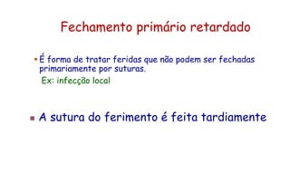 Fechamento primário retardado
 É forma de tratar feridas que não podem ser fechadas
primariamente por suturas.
Ex: infecção local
 A sutura do ferimento é feita tardiamente
 