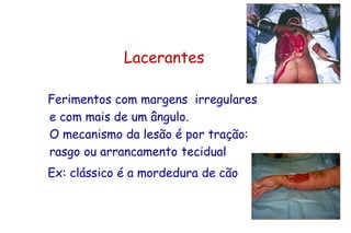 Lacerantes
Ferimentos com margens irregulares
e com mais de um ângulo.
O mecanismo da lesão é por tração:
rasgo ou arrancamento tecidual
Ex: clássico é a mordedura de cão
 