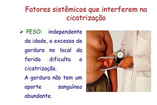 Fatores sistêmicos que interferem na
cicatrização
 PESO: independente
da idade, o excesso de
gordura no local da
ferida dificulta a
cicatrização.
A gordura não tem um
aporte sanguíneo
abundante.
 