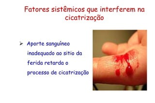 Fatores sistêmicos que interferem na
cicatrização
 Aporte sanguíneo
inadequado ao sitio da
ferida retarda o
processo de cicatrização
 