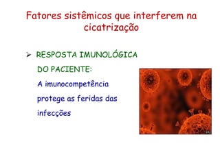 Fatores sistêmicos que interferem na
cicatrização
 RESPOSTA IMUNOLÓGICA
DO PACIENTE:
A imunocompetência
protege as feridas das
infecções
 