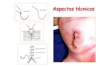 Aspectos técnicos
 