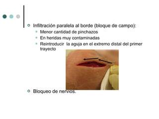  Infiltración paralela al borde (bloque de campo):
 Menor cantidad de pinchazos
 En heridas muy contaminadas
 Reintroducir la aguja en el extremo distal del primer
trayecto
 Bloqueo de nervios.
 