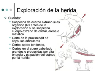 Exploración de la herida
 Cuando:
 Sospecha de cuerpo extraño si es
orgánico (Rx antes de la
exploración si se sospecha
cuerpo extraño de cristal, arena o
metálico
 Corte en la proximidad de
cápsulas articulares
 Cortes sobre tendones,
 Cortes en el cuero cabelludo
grandes o producidas por alta
energía y palpación del cráneo
por la herida
 