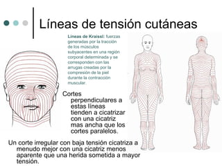 Líneas de tensión cutáneas
Un corte irregular con baja tensión cicatriza a
menudo mejor con una cicatriz menos
aparente que una herida sometida a mayor
tensión.
Líneas de Kraissl: fuerzas
generadas por la tracción
de los músculos
subyacentes en una región
corporal determinada y se
corresponden con las
arrugas creadas por la
compresión de la piel
durante la contracción
muscular.
Cortes
perpendiculares a
estas líneas
tienden a cicatrizar
con una cicatriz
mas ancha que los
cortes paralelos.
 