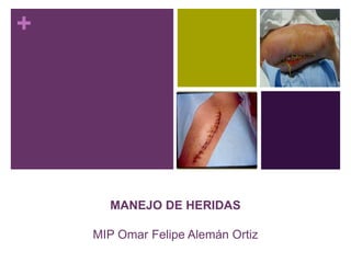 +
MANEJO DE HERIDAS
MIP Omar Felipe Alemán Ortiz
 